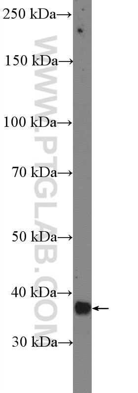 Western Blot (WB) analysis of mouse skeletal muscle tissue using MEF2B (isoform 365aa)-Specific Polyclonal antibody (18710-1-AP)