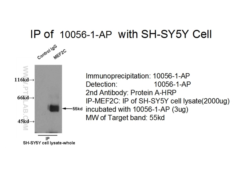 Immunoprecipitation (IP) experiment using MEF2C Polyclonal antibody (10056-1-AP)