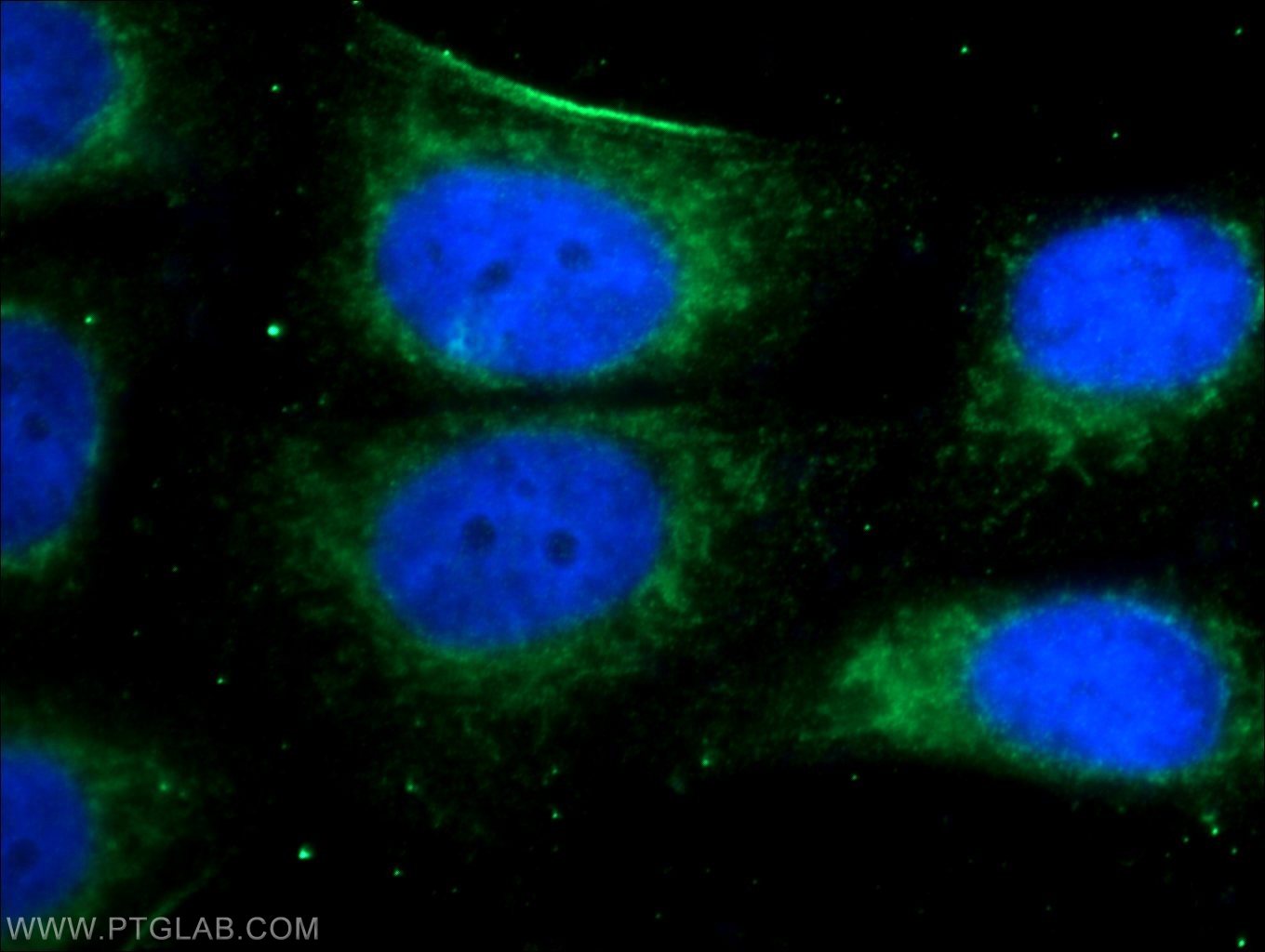 MEF2C Polyclonal antibody