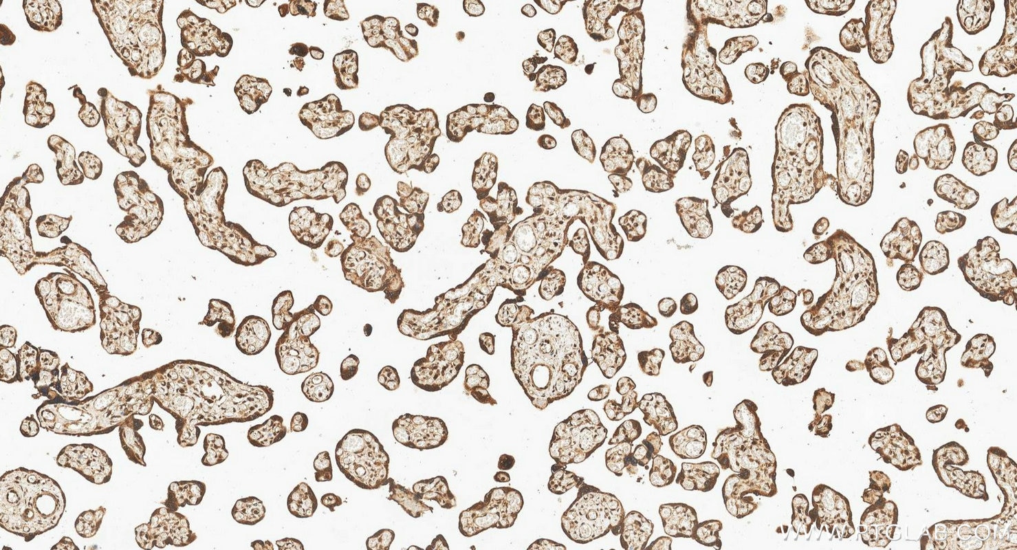 IHC staining of human placenta using 10056-1-AP Immunohistochemistry (IHC) staining of human placenta tissue using MEF2C Polyclonal antibody (10056-1-AP)