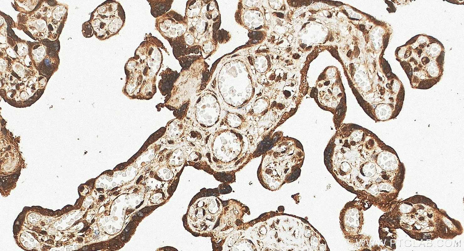 IHC staining of human placenta using 10056-1-AP Immunohistochemistry (IHC) staining of human placenta tissue using MEF2C Polyclonal antibody (10056-1-AP)