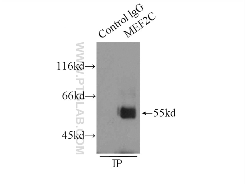 Immunoprecipitation (IP) experiment of SH-SY5Y cells using MEF2C Polyclonal antibody (10056-1-AP)