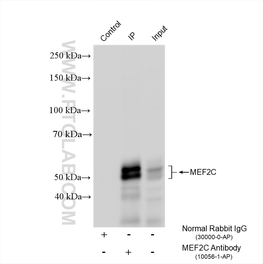 Immunoprecipitation (IP) experiment of mouse brain tissue using MEF2C Polyclonal antibody (10056-1-AP)