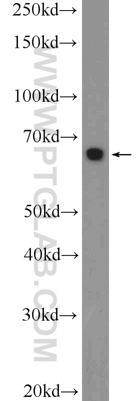 Western Blot (WB) analysis of mouse colon tissue using MEF2C Polyclonal antibody (10056-1-AP)
