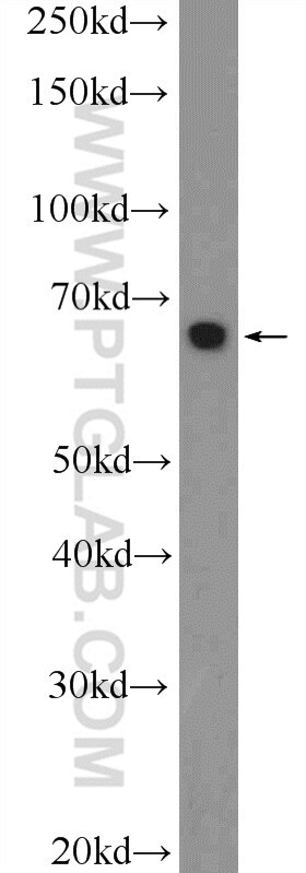 WB analysis of mouse colon using 10056-1-AP