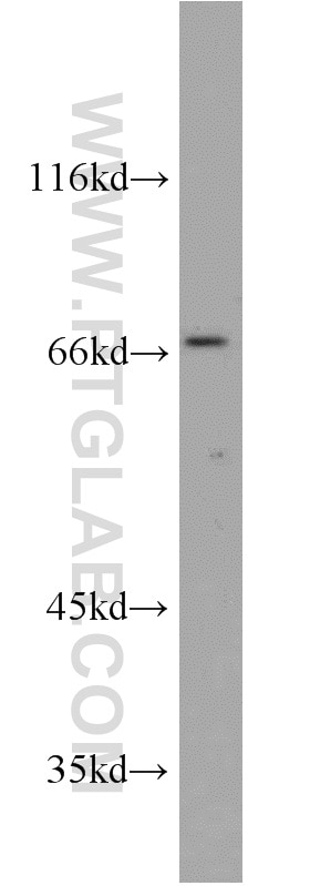 Western Blot (WB) analysis of mouse colon tissue using MEF2C Polyclonal antibody (10056-1-AP)