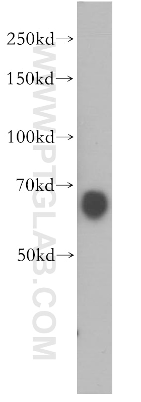 Western Blot (WB) analysis of SH-SY5Y cells using MEF2C Polyclonal antibody (10056-1-AP)