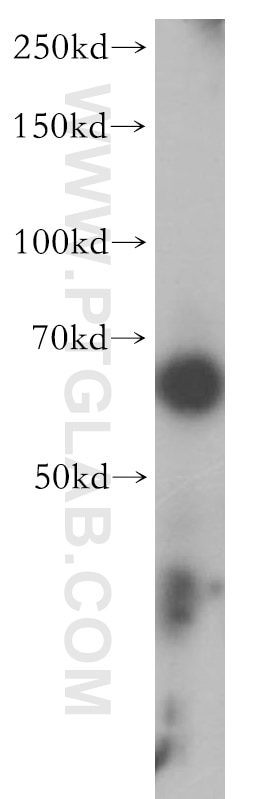 Western Blot (WB) analysis of mouse colon tissue using MEF2C Polyclonal antibody (10056-1-AP)