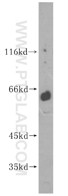 Western Blot (WB) analysis of HeLa cells using MEF2C Polyclonal antibody (16953-1-AP)