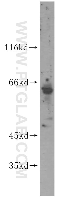 Western Blot (WB) analysis of mouse skeletal muscle tissue using MEF2C Polyclonal antibody (16953-1-AP)