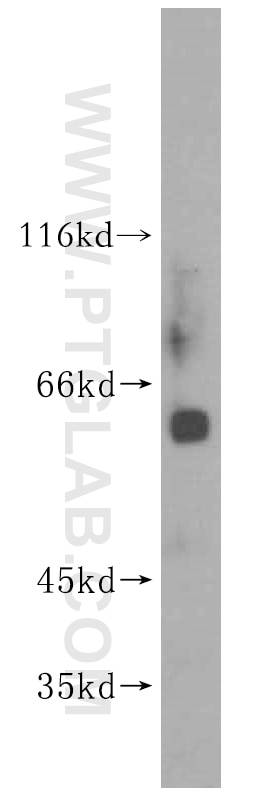 Western Blot (WB) analysis of human heart tissue using MEF2C Polyclonal antibody (16953-1-AP)