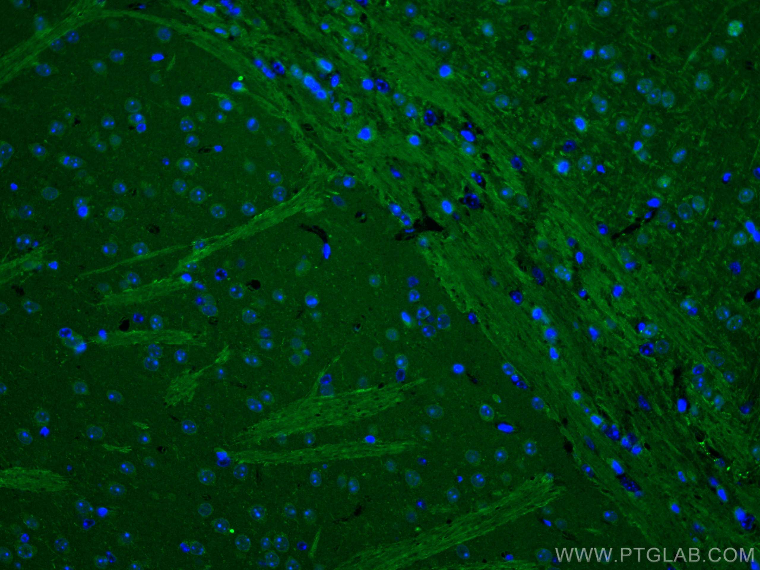 IF Staining of mouse brain using 18290-1-AP