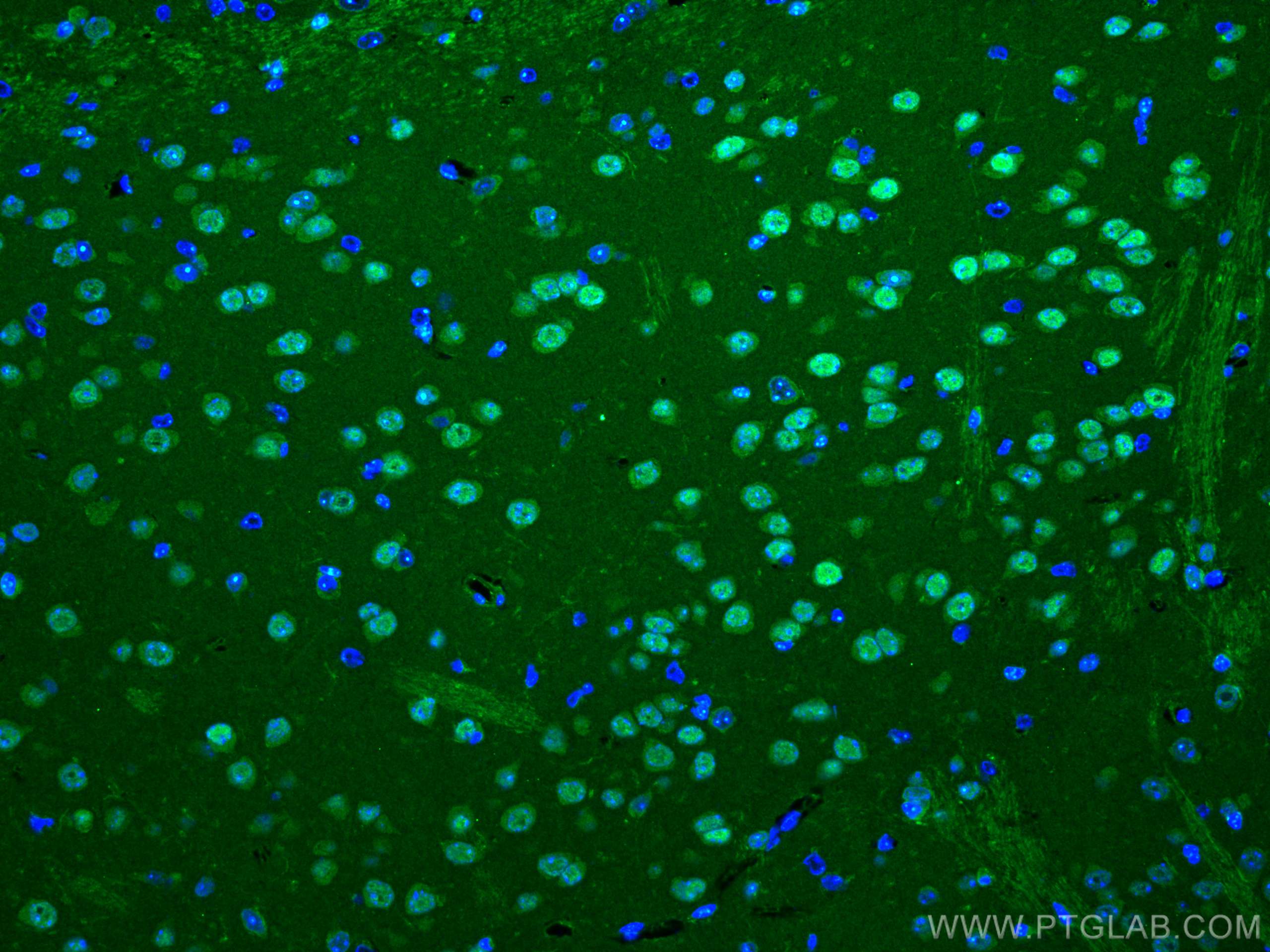 Immunofluorescence (IF) / fluorescent staining of mouse brain tissue using MEF2C Polyclonal antibody (18290-1-AP)
