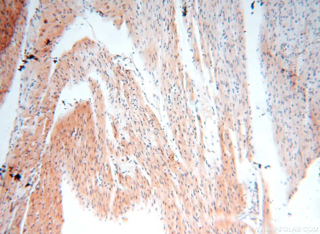 Immunohistochemistry (IHC) staining of human heart tissue using MEF2C Polyclonal antibody (18290-1-AP)