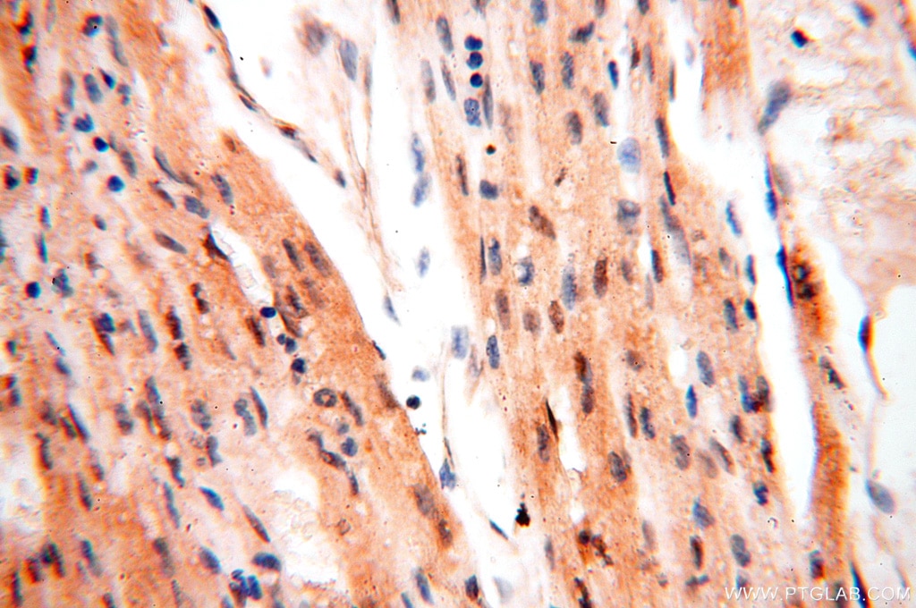 IHC staining of human heart using 18290-1-AP