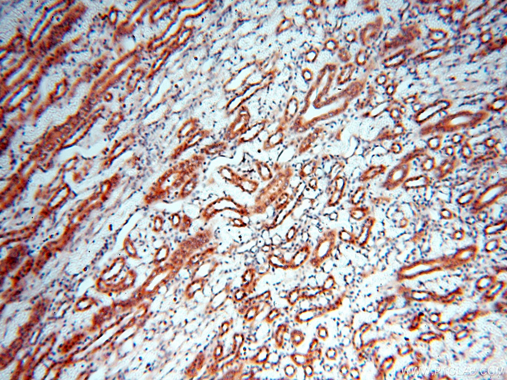 Immunohistochemistry (IHC) staining of human kidney tissue using MEF2C Polyclonal antibody (18290-1-AP)