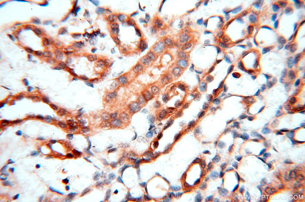 Immunohistochemistry (IHC) staining of human kidney tissue using MEF2C Polyclonal antibody (18290-1-AP)