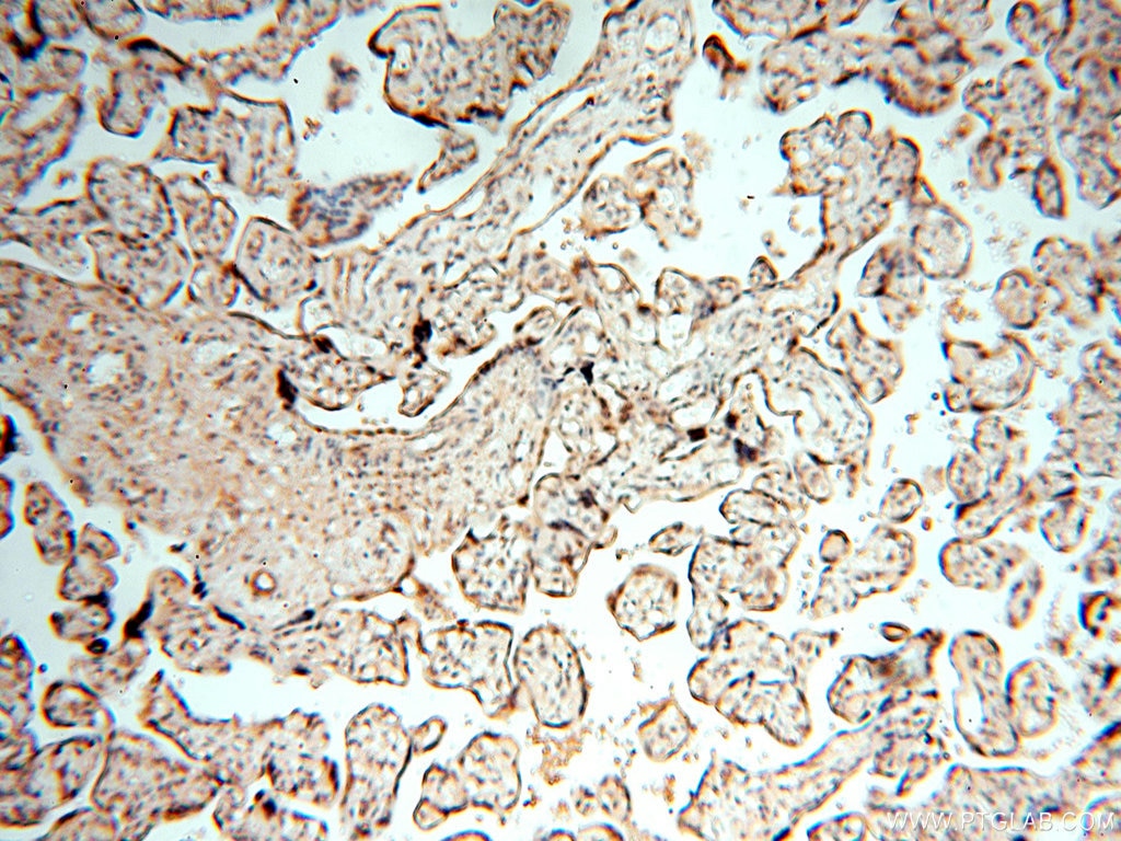 Immunohistochemistry (IHC) staining of human placenta tissue using MEF2C Polyclonal antibody (18290-1-AP)