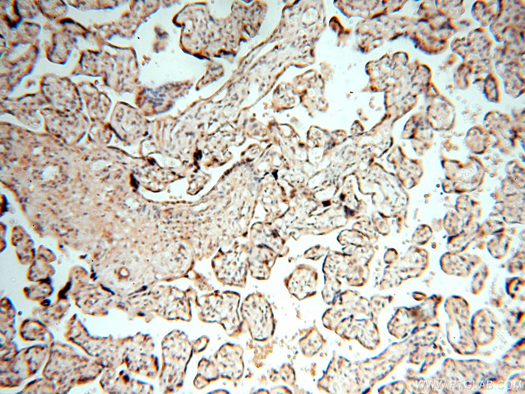 IHC staining of human placenta using 18290-1-AP