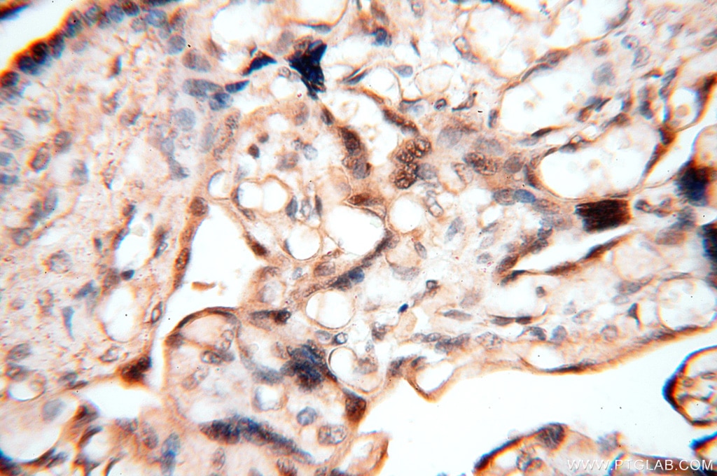 IHC staining of human placenta using 18290-1-AP