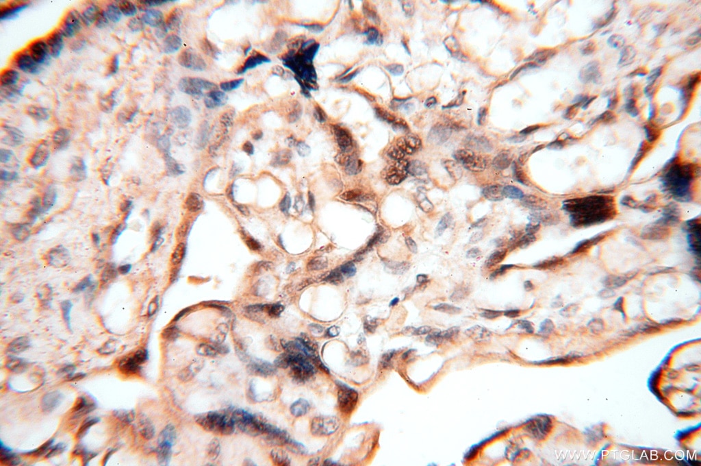 Immunohistochemistry (IHC) staining of human placenta tissue using MEF2C Polyclonal antibody (18290-1-AP)