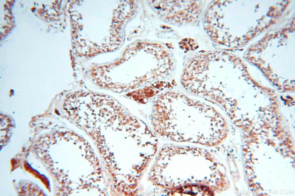 Immunohistochemistry (IHC) staining of human testis tissue using MEF2C Polyclonal antibody (18290-1-AP)