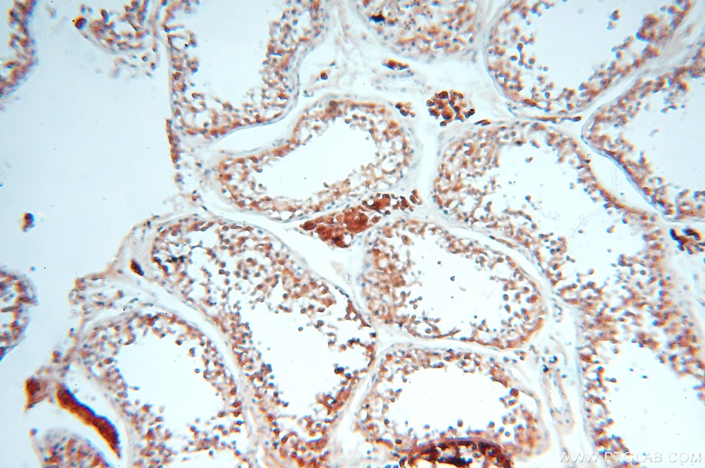 IHC staining of human testis using 18290-1-AP