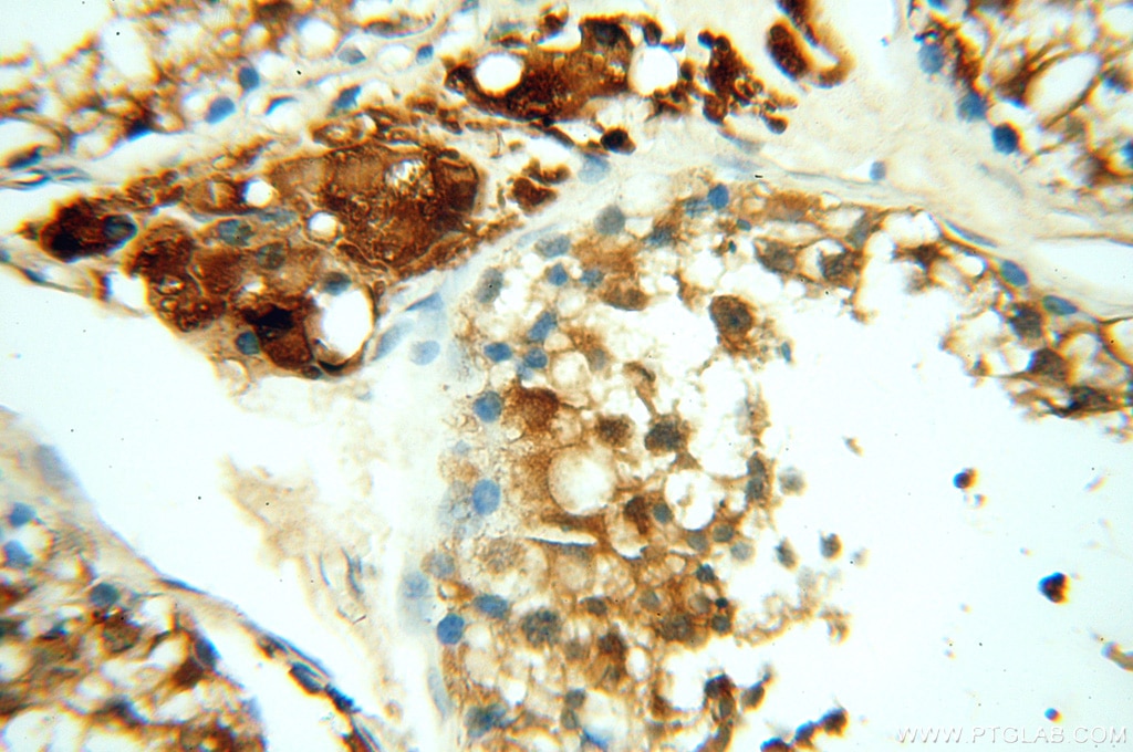 Immunohistochemistry (IHC) staining of human testis tissue using MEF2C Polyclonal antibody (18290-1-AP)