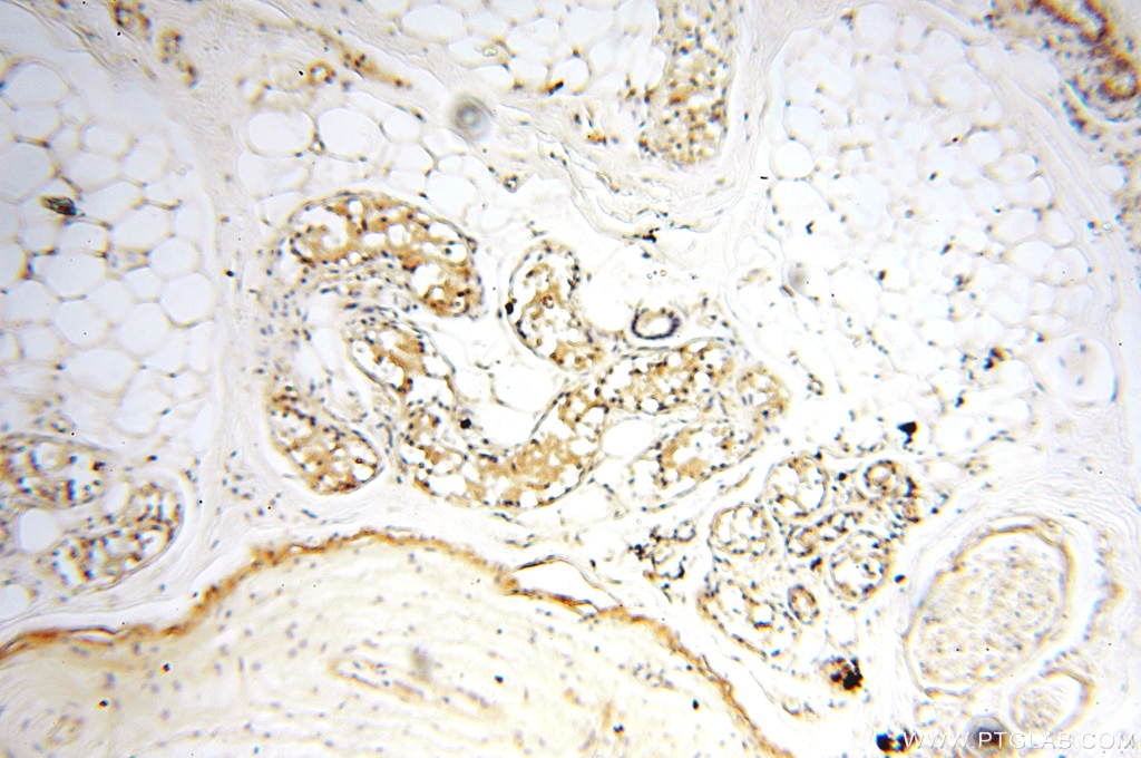 Immunohistochemistry (IHC) staining of human skin tissue using MEF2C Polyclonal antibody (18290-1-AP)