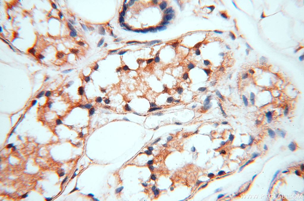 Immunohistochemistry (IHC) staining of human skin tissue using MEF2C Polyclonal antibody (18290-1-AP)