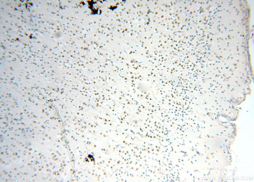 Immunohistochemistry (IHC) staining of human brain tissue using MEF2C Polyclonal antibody (18290-1-AP)