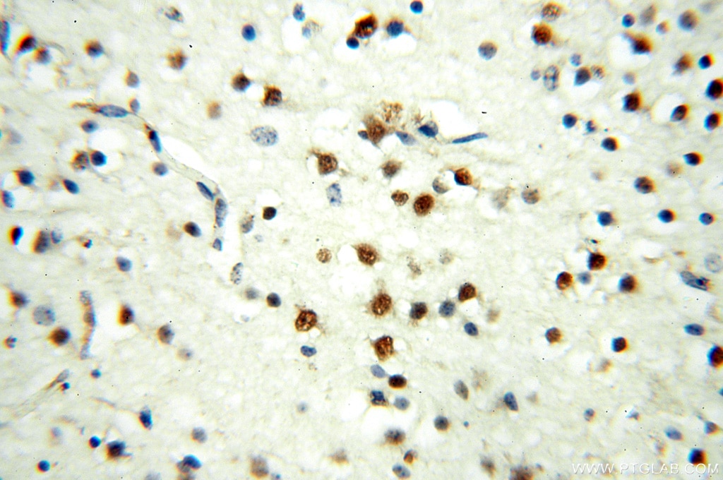 Immunohistochemistry (IHC) staining of human brain tissue using MEF2C Polyclonal antibody (18290-1-AP)