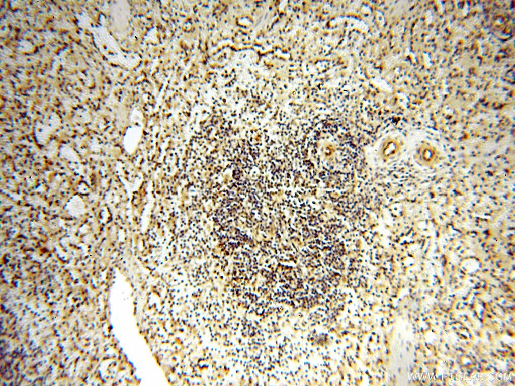 IHC staining of human spleen using 18290-1-AP