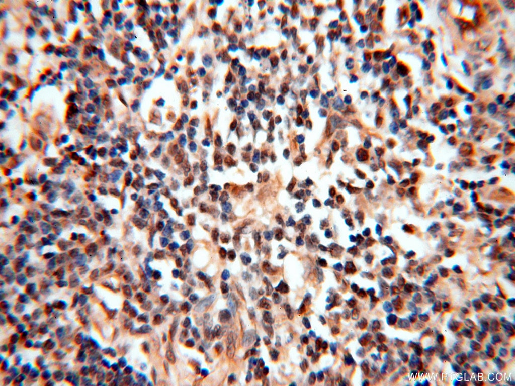Immunohistochemistry (IHC) staining of human spleen tissue using MEF2C Polyclonal antibody (18290-1-AP)