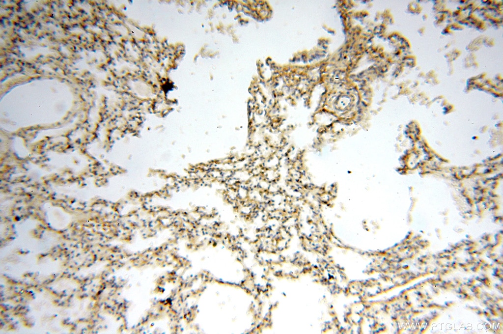 Immunohistochemistry (IHC) staining of human lung tissue using MEF2C Polyclonal antibody (18290-1-AP)