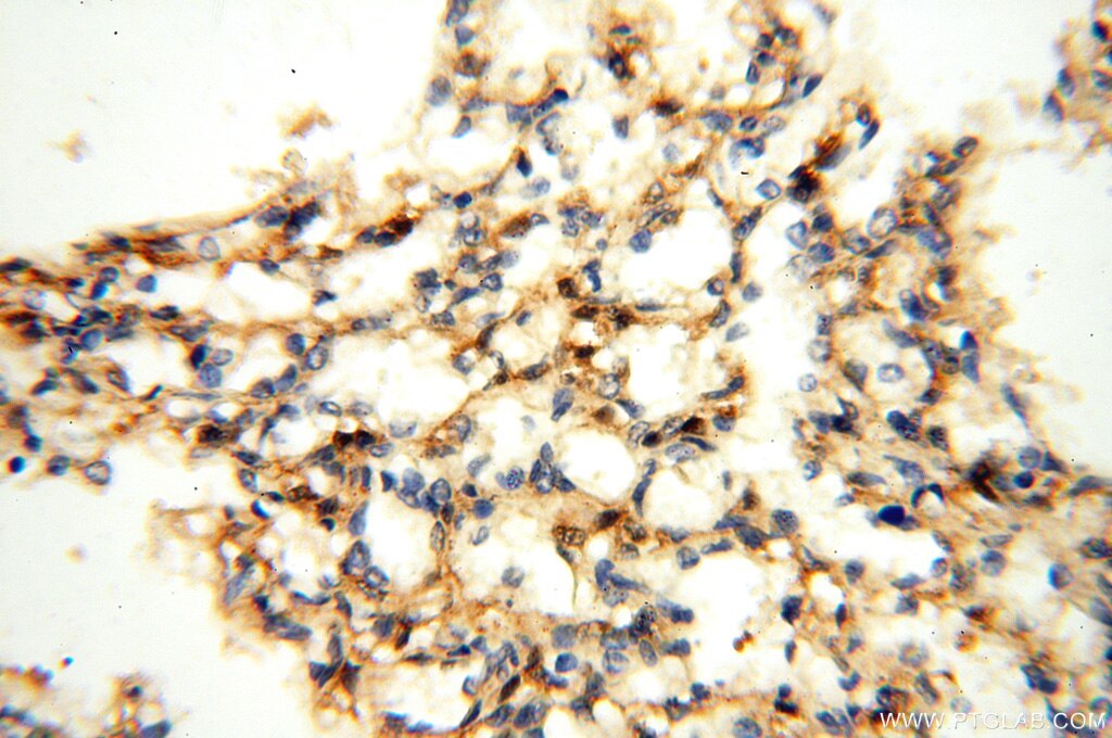Immunohistochemistry (IHC) staining of human lung tissue using MEF2C Polyclonal antibody (18290-1-AP)