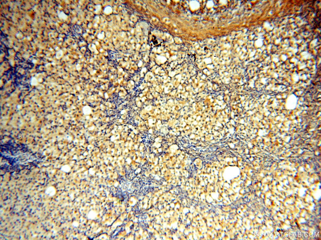 Immunohistochemistry (IHC) staining of human ovary tissue using MEF2C Polyclonal antibody (18290-1-AP)
