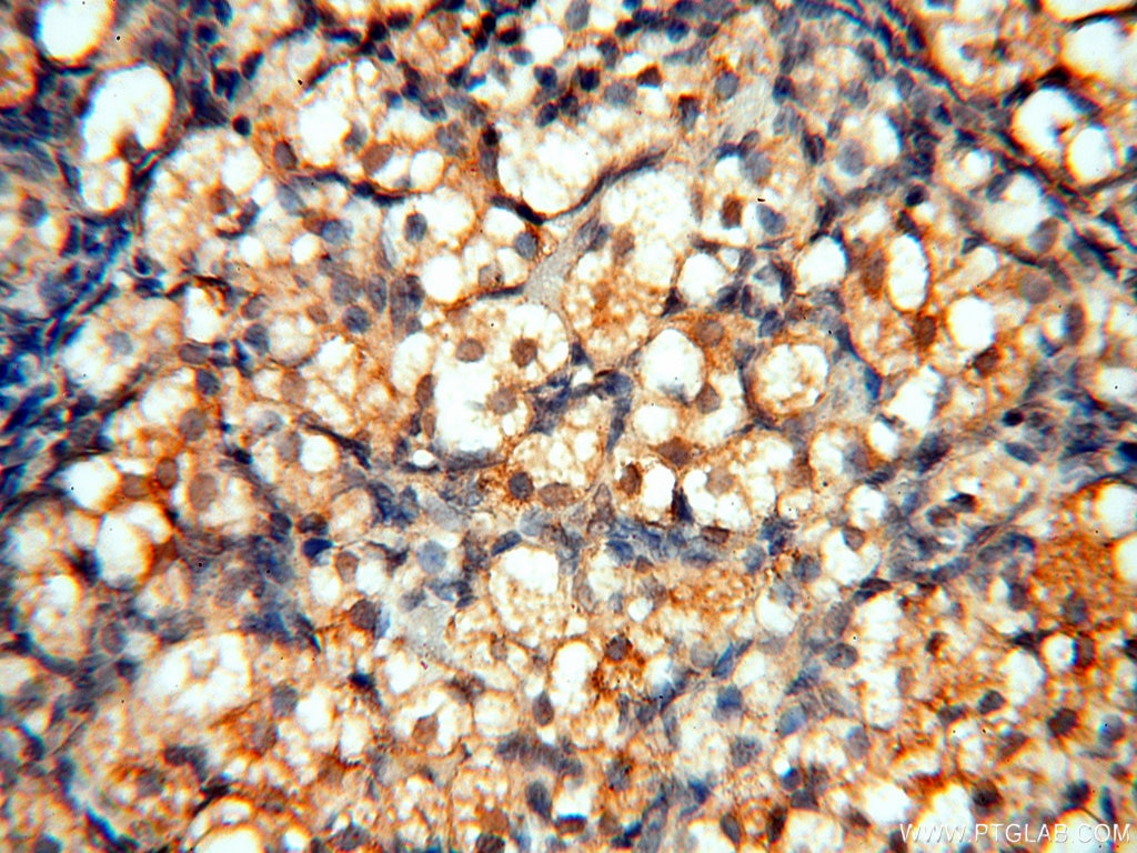 Immunohistochemistry (IHC) staining of human ovary tissue using MEF2C Polyclonal antibody (18290-1-AP)