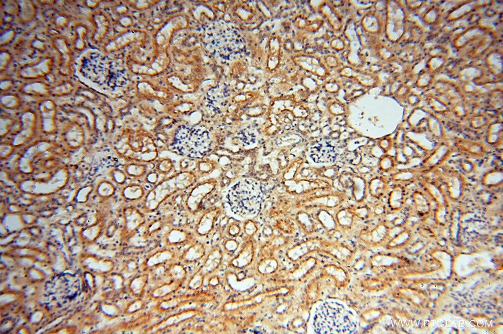 Immunohistochemistry (IHC) staining of human kidney tissue using MEF2C Polyclonal antibody (18291-1-AP)