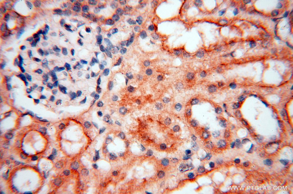 Immunohistochemistry (IHC) staining of human kidney tissue using MEF2C Polyclonal antibody (18291-1-AP)