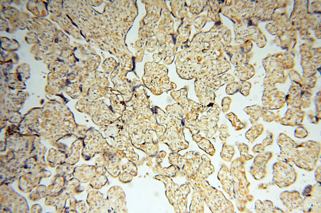 Immunohistochemistry (IHC) staining of human placenta tissue using MEF2C Polyclonal antibody (18291-1-AP)