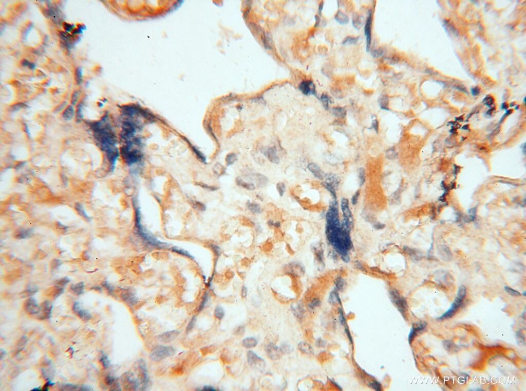 Immunohistochemistry (IHC) staining of human placenta tissue using MEF2C Polyclonal antibody (18291-1-AP)