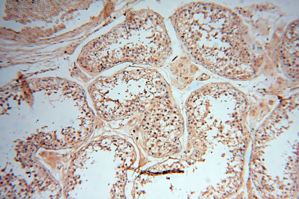 IHC staining of human testis using 18291-1-AP