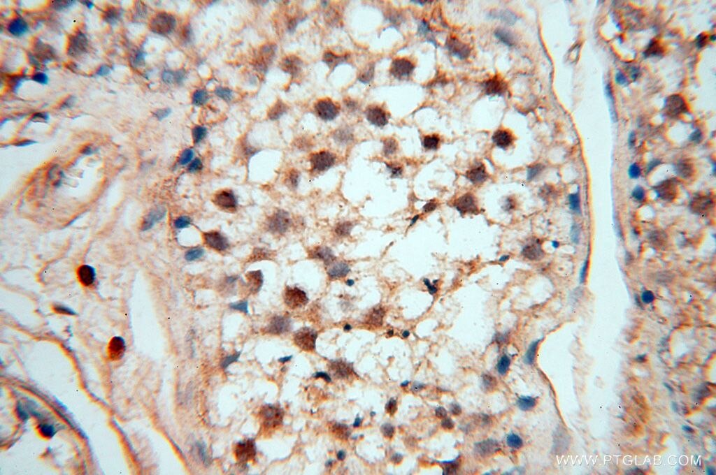 Immunohistochemistry (IHC) staining of human testis tissue using MEF2C Polyclonal antibody (18291-1-AP)