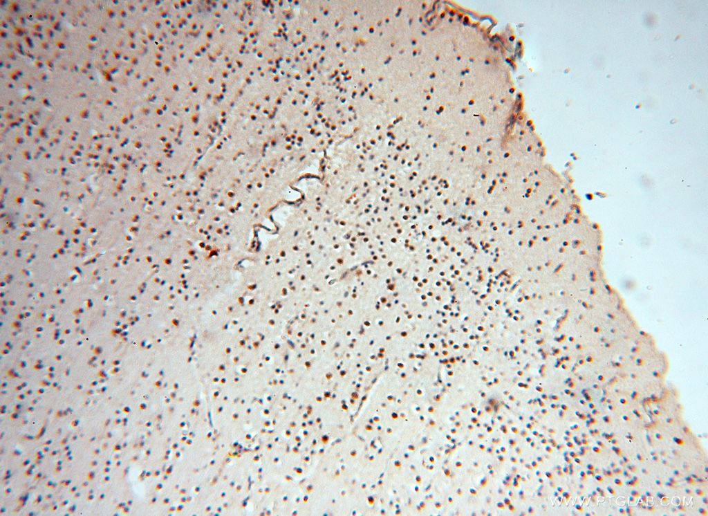 Immunohistochemistry (IHC) staining of human brain tissue using MEF2C Polyclonal antibody (18291-1-AP)