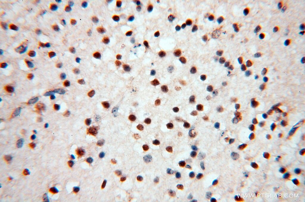 Immunohistochemistry (IHC) staining of human brain tissue using MEF2C Polyclonal antibody (18291-1-AP)