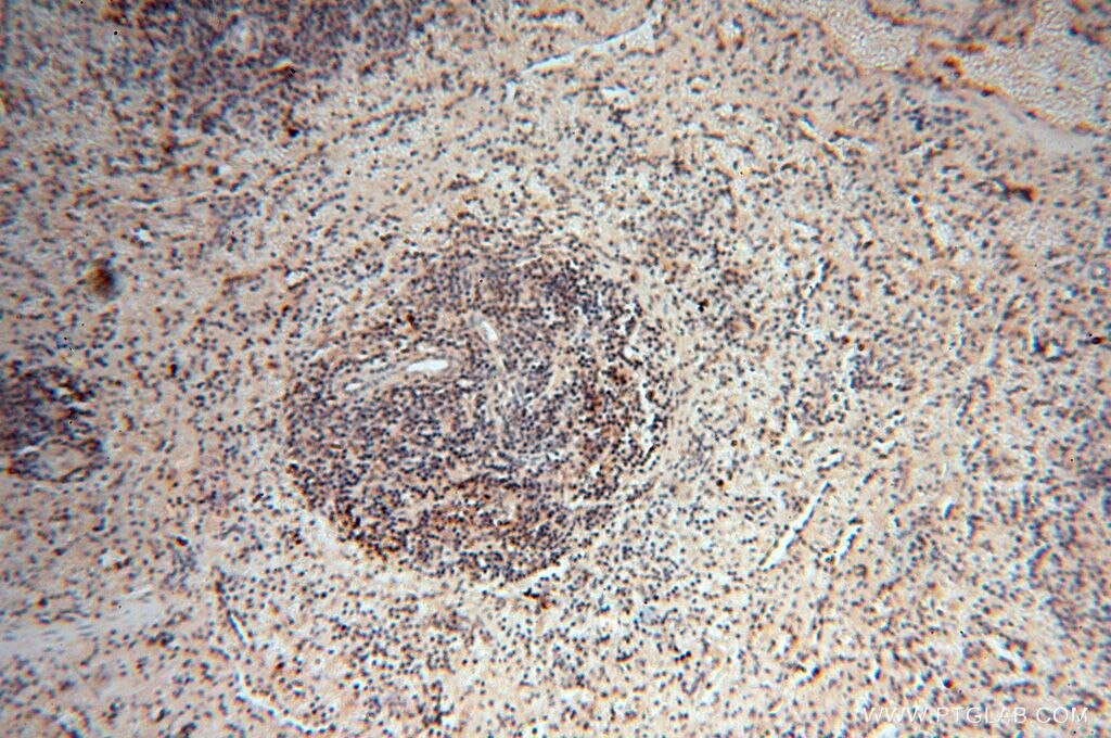 Immunohistochemistry (IHC) staining of human spleen tissue using MEF2C Polyclonal antibody (18291-1-AP)