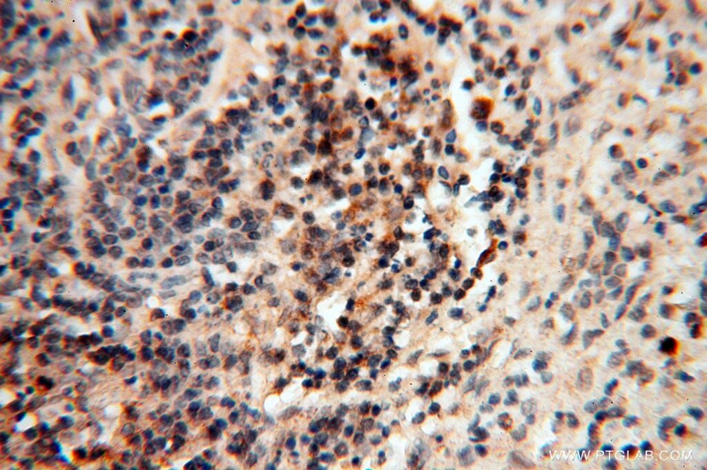 Immunohistochemistry (IHC) staining of human spleen tissue using MEF2C Polyclonal antibody (18291-1-AP)