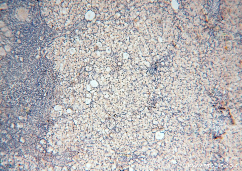 Immunohistochemistry (IHC) staining of human ovary tissue using MEF2C Polyclonal antibody (18291-1-AP)