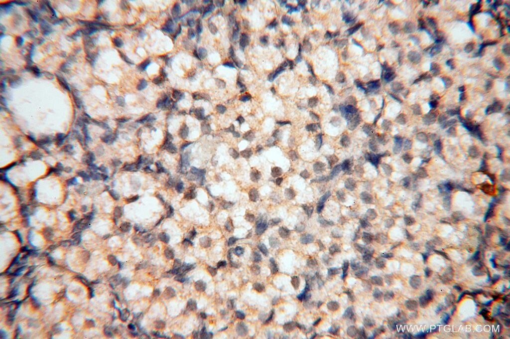 Immunohistochemistry (IHC) staining of human ovary tissue using MEF2C Polyclonal antibody (18291-1-AP)